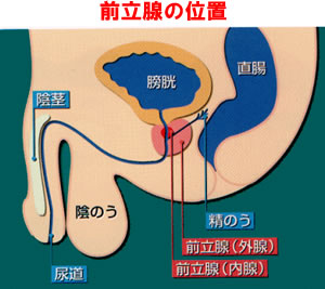 前立腺肥大症について